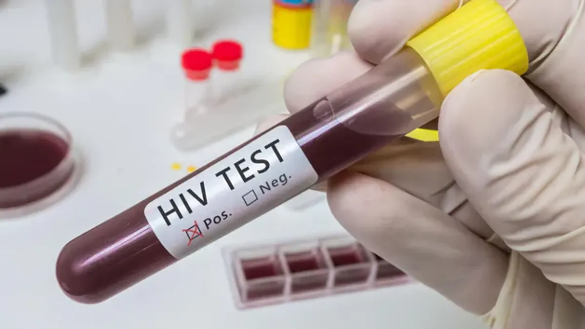 Przełom w badaniach nad HIV. Odkryto, jak wirus integruje się z DNA człowieka