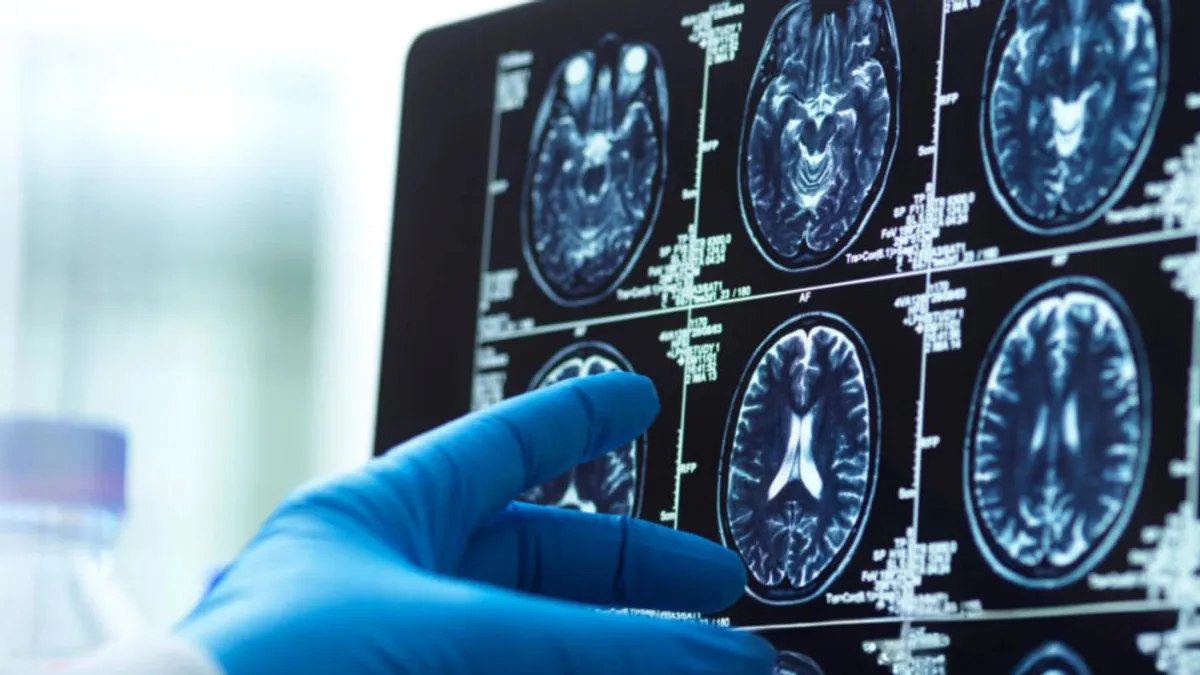 Przełomowe odkrycie w badaniach nad chorobą Alzheimera. Naukowcom udało się przywrócić funkcje poznawcze