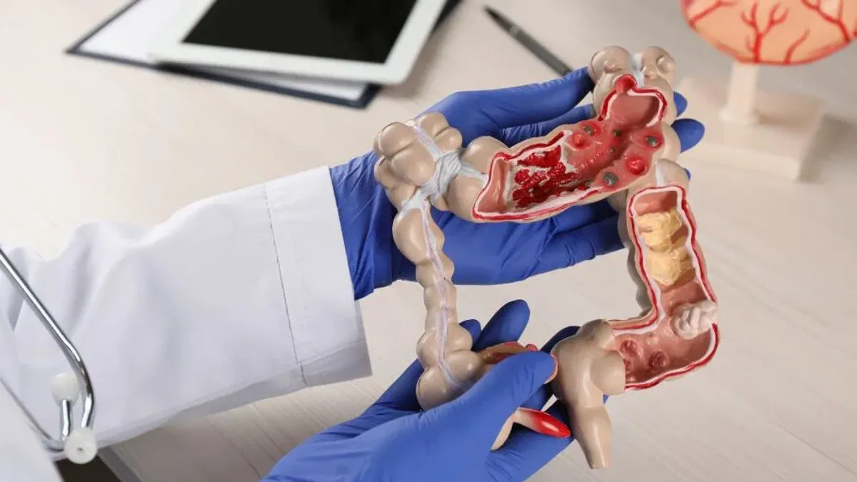 Rak jelita grubego - jak zwiększyć czujność i wczesne wykrycie