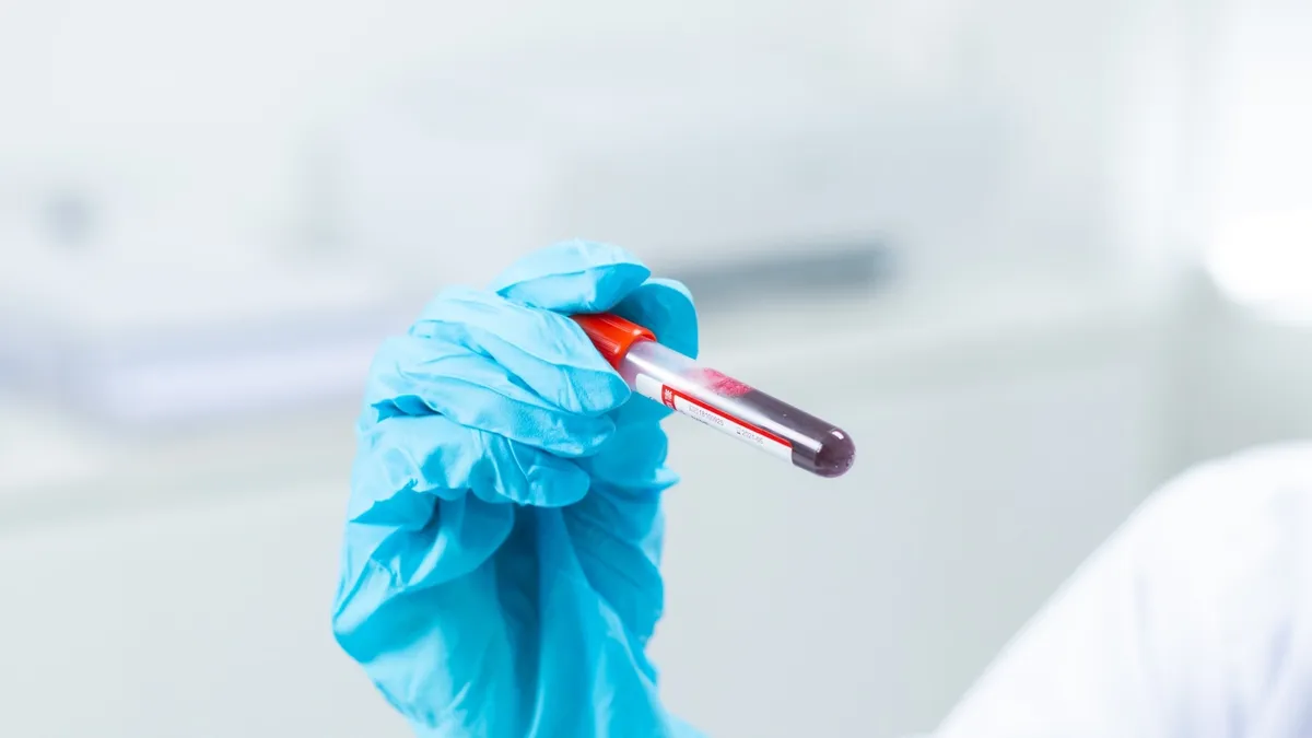Test z krwi na biomarker p-tau217 może przewidywać ryzyko demencji
